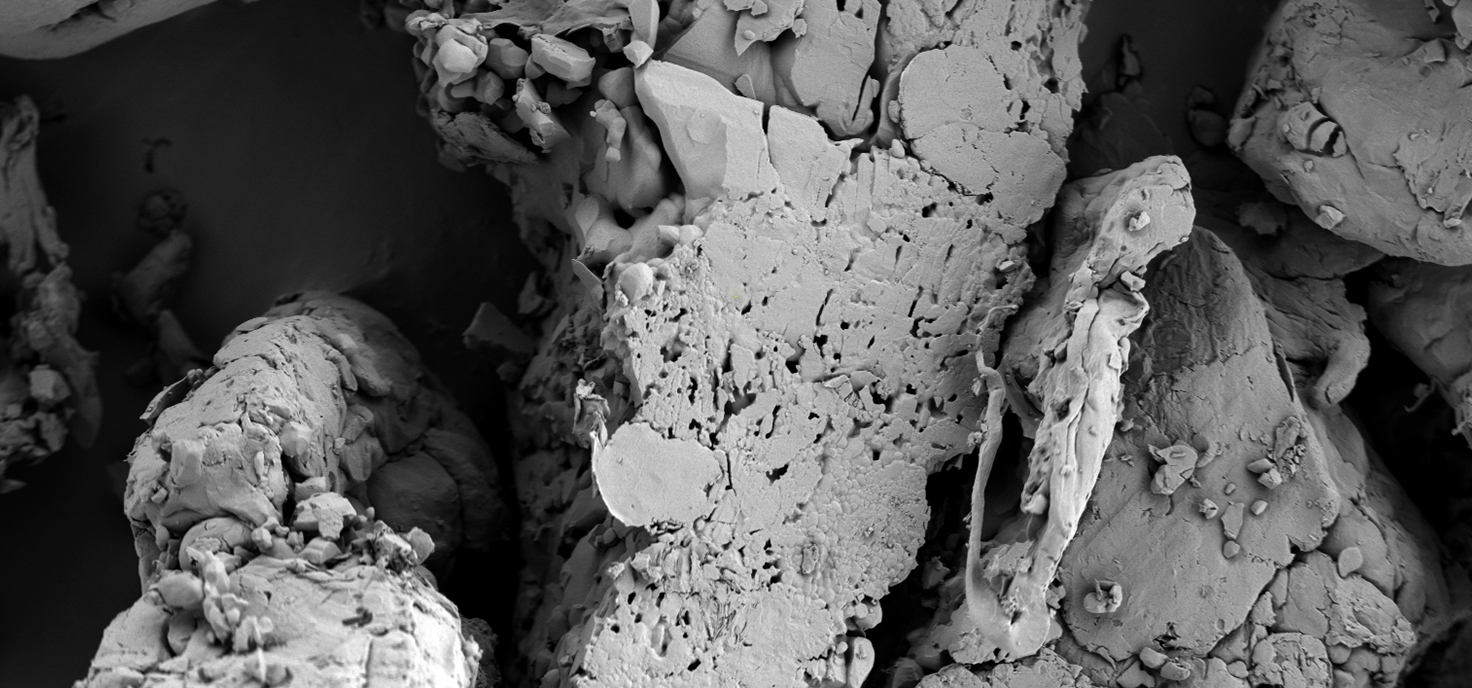 Rapid imaging with no ghosting or trailing, delivering sharp detail