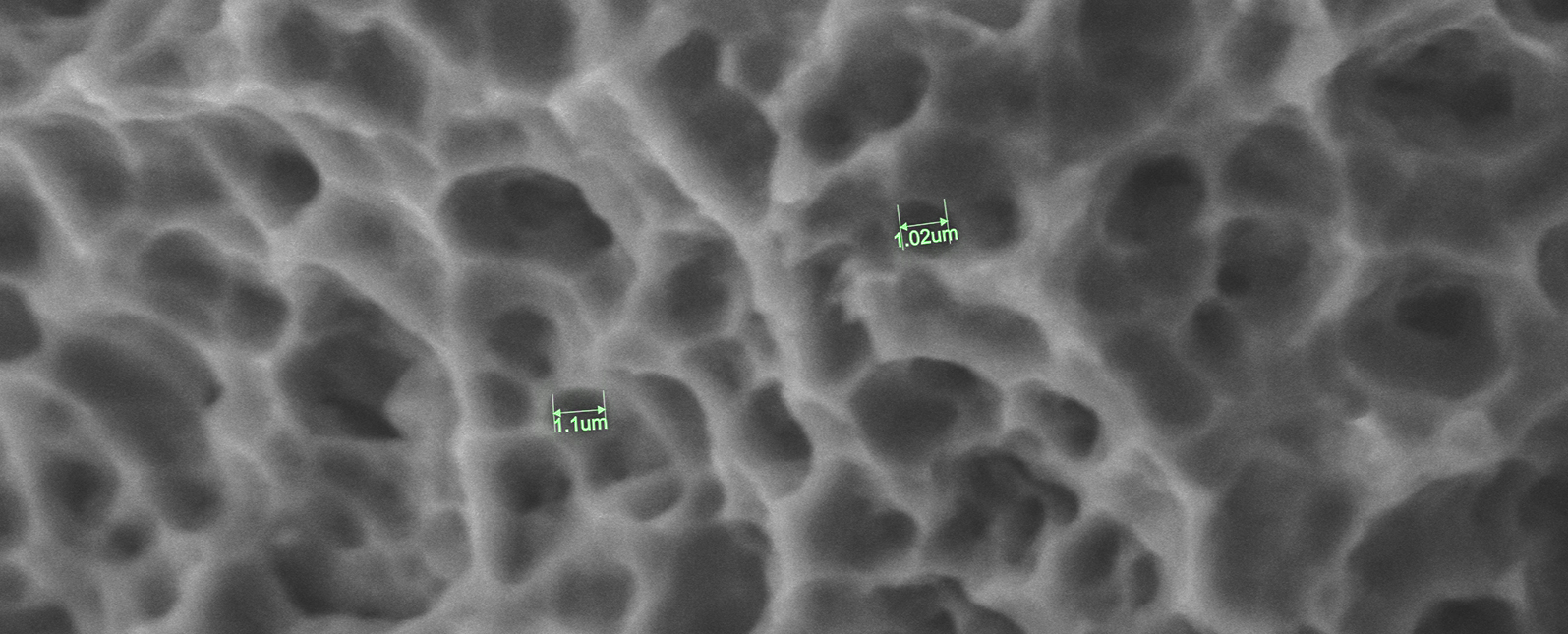 Application of SuperSEM N10eX in the Microscopic Inspection of Dental Implants