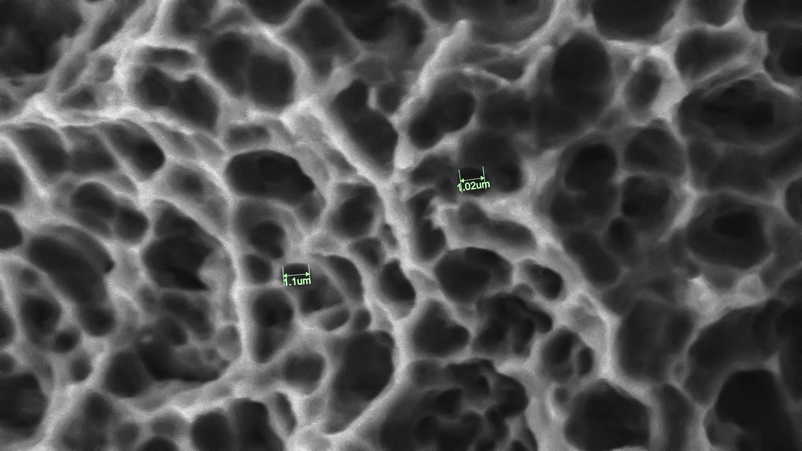 Application of SuperSEM N10eX in the Microscopic Inspection of Dental Implants(图2)